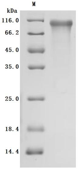 (Tris-Glycine gel) Discontinuous SDS-PAGE (reduced) with 5% enrichment gel and 15% separation gel.