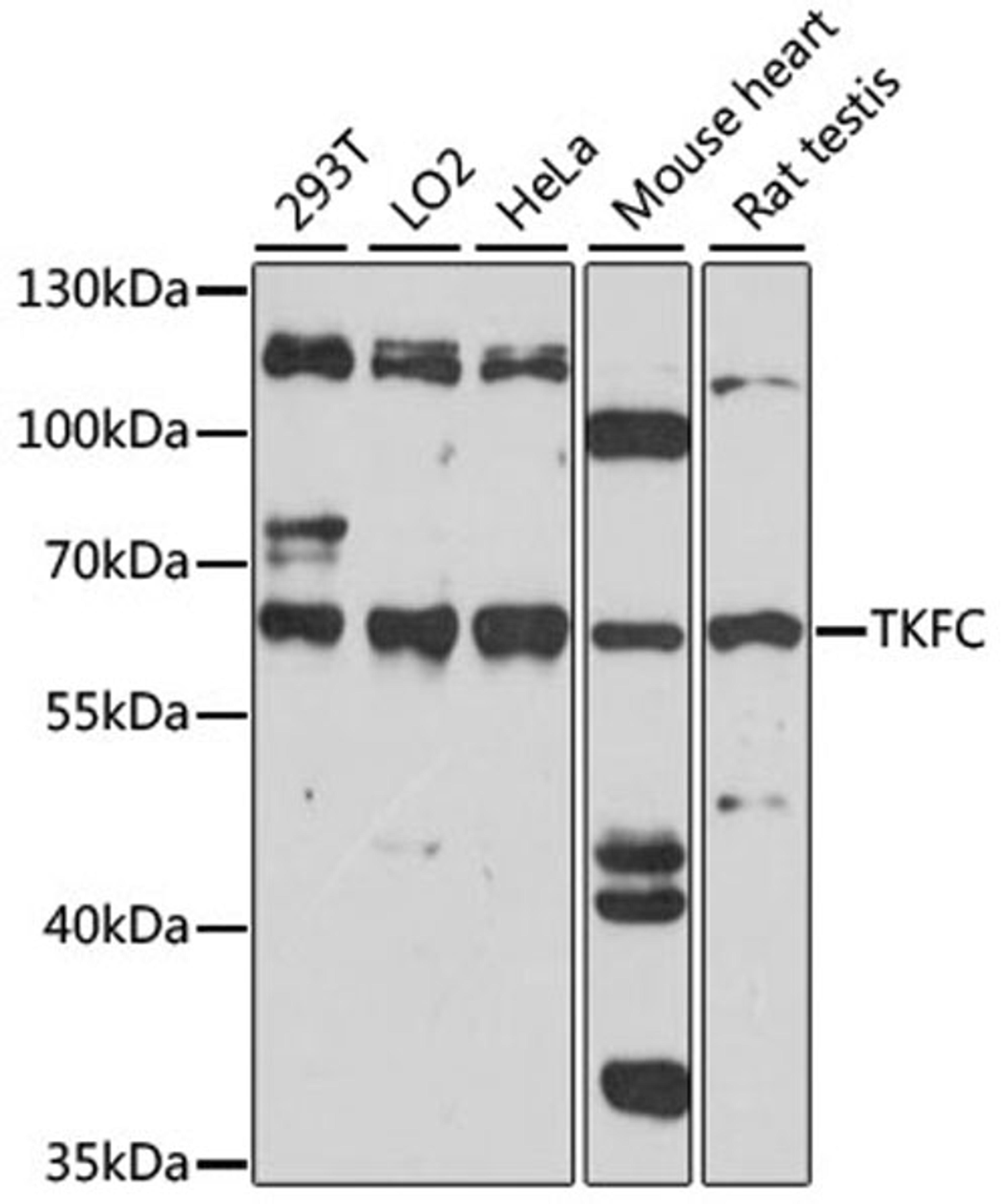 Western blot - TKFC antibody (A15421)