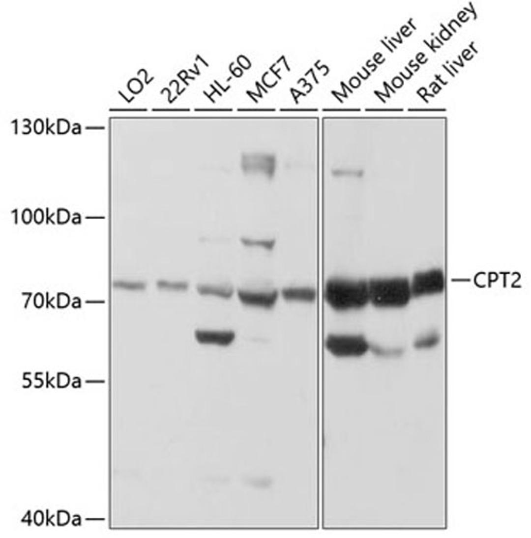 Western blot - CPT2 antibody (A12426)