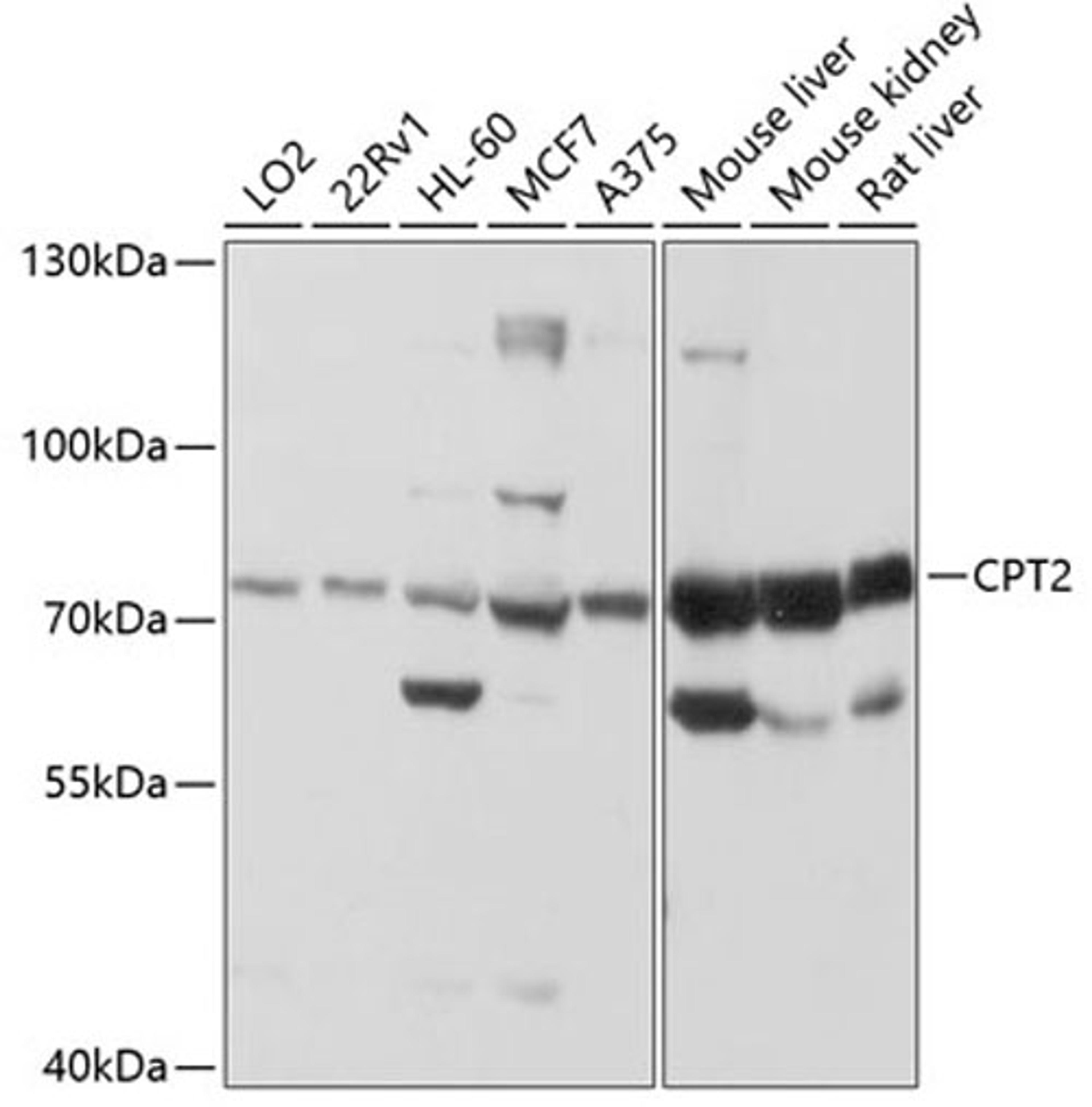 Western blot - CPT2 antibody (A12426)