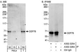 Detection of human CEP76 by western blot and immunoprecipitation.