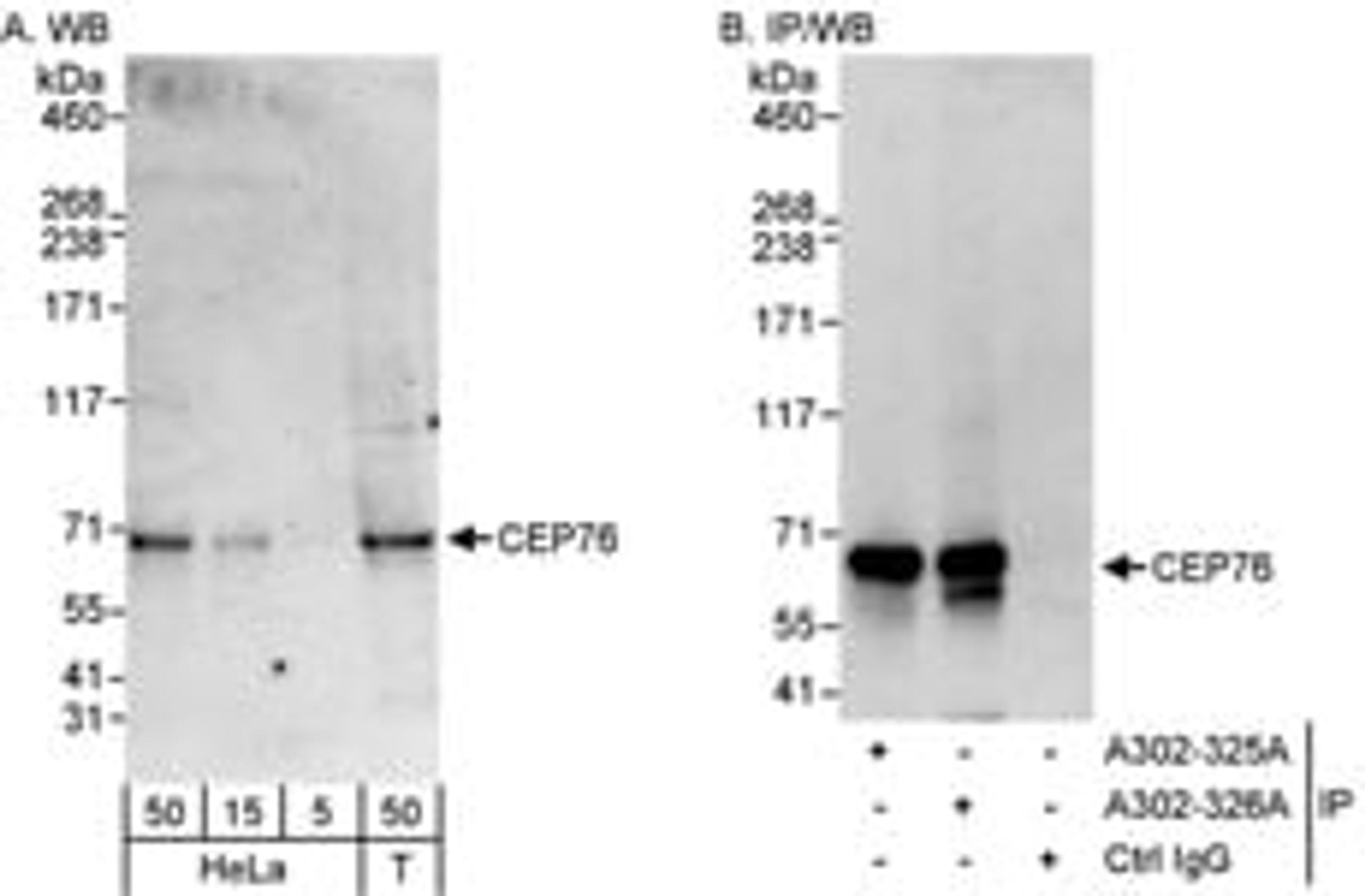 Detection of human CEP76 by western blot and immunoprecipitation.