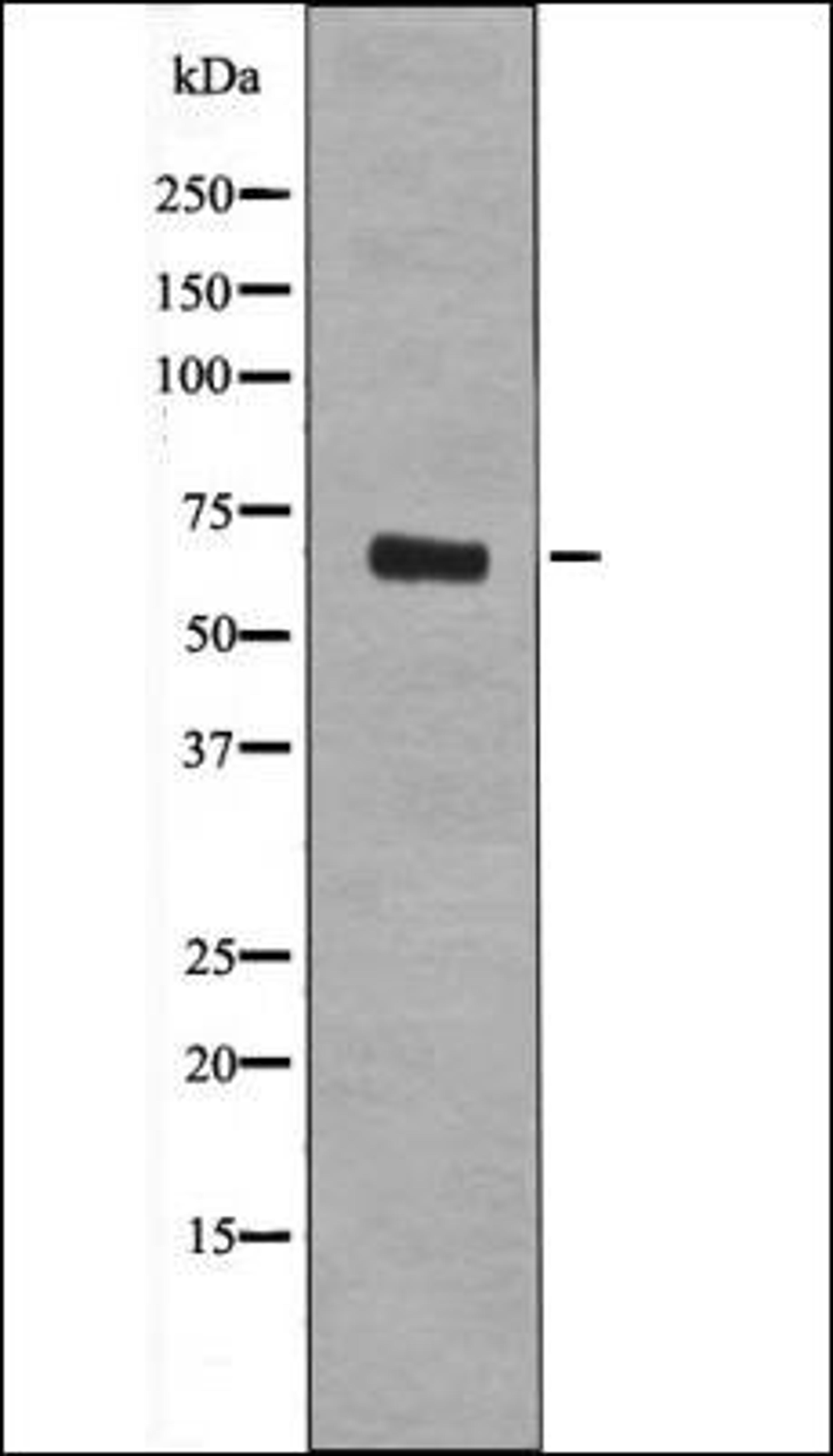 Western blot analysis of Paclitaxel treated HeLa whole cell lysates using Rel -Phospho-Ser492/460- antibody