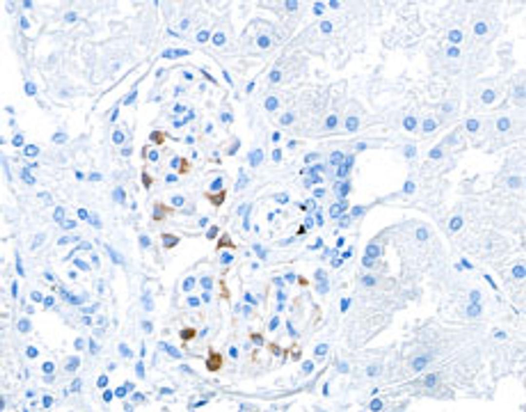 Detection of human ZO-1 in FFPE kidney by IHC.