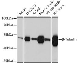 Western blot - ß-Tubulin antibody (AC010)