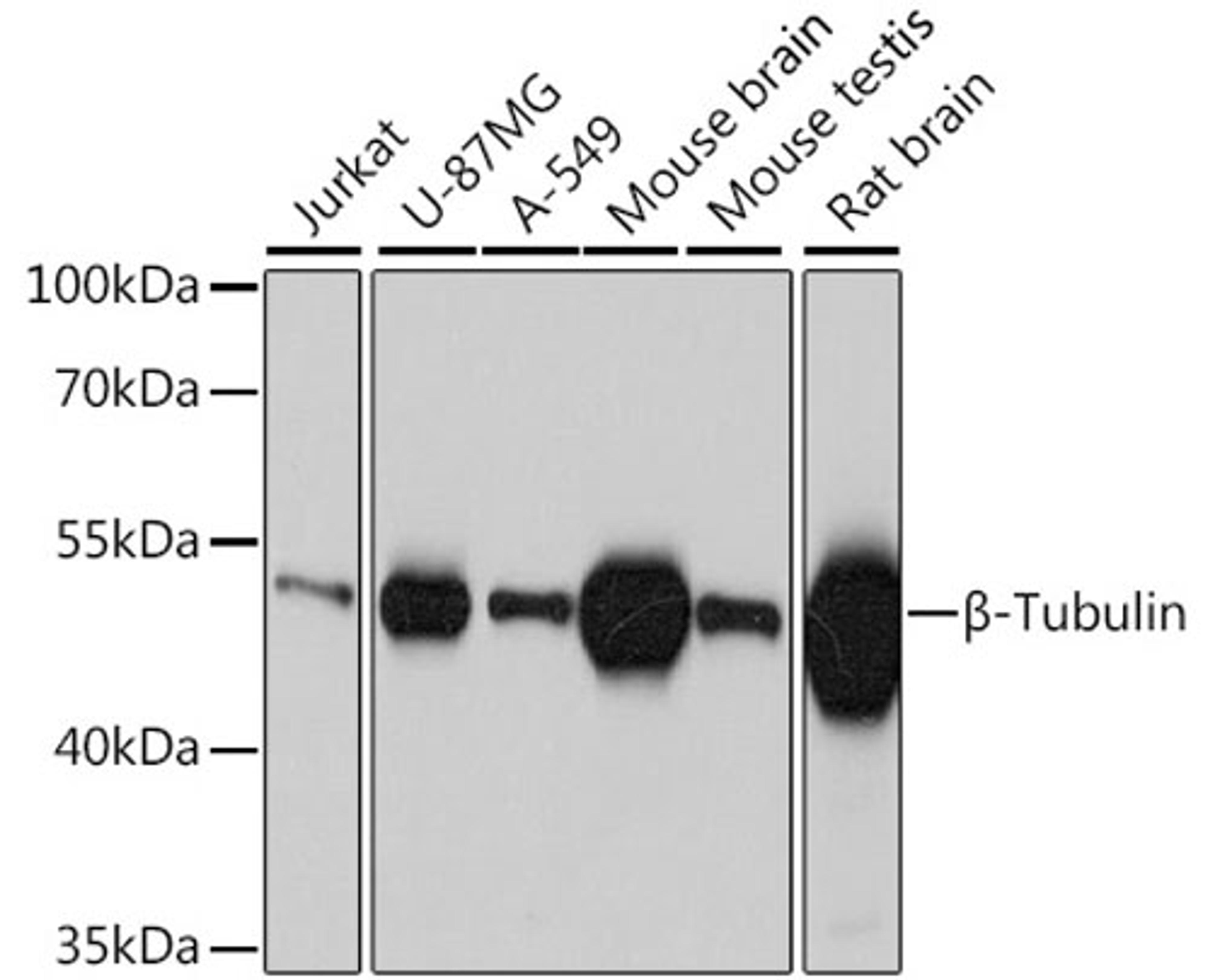 Western blot - ß-Tubulin antibody (AC010)