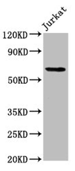 Western Blot. Positive WB detected in: Jurkat whole cell lysate. All lanes: SLAIN1 antibody at 4.2µg/ml. Secondary. Goat polyclonal to rabbit IgG at 1/50000 dilution. Predicted band size: 61, 34, 21, 48 kDa. Observed band size: 61 kDa