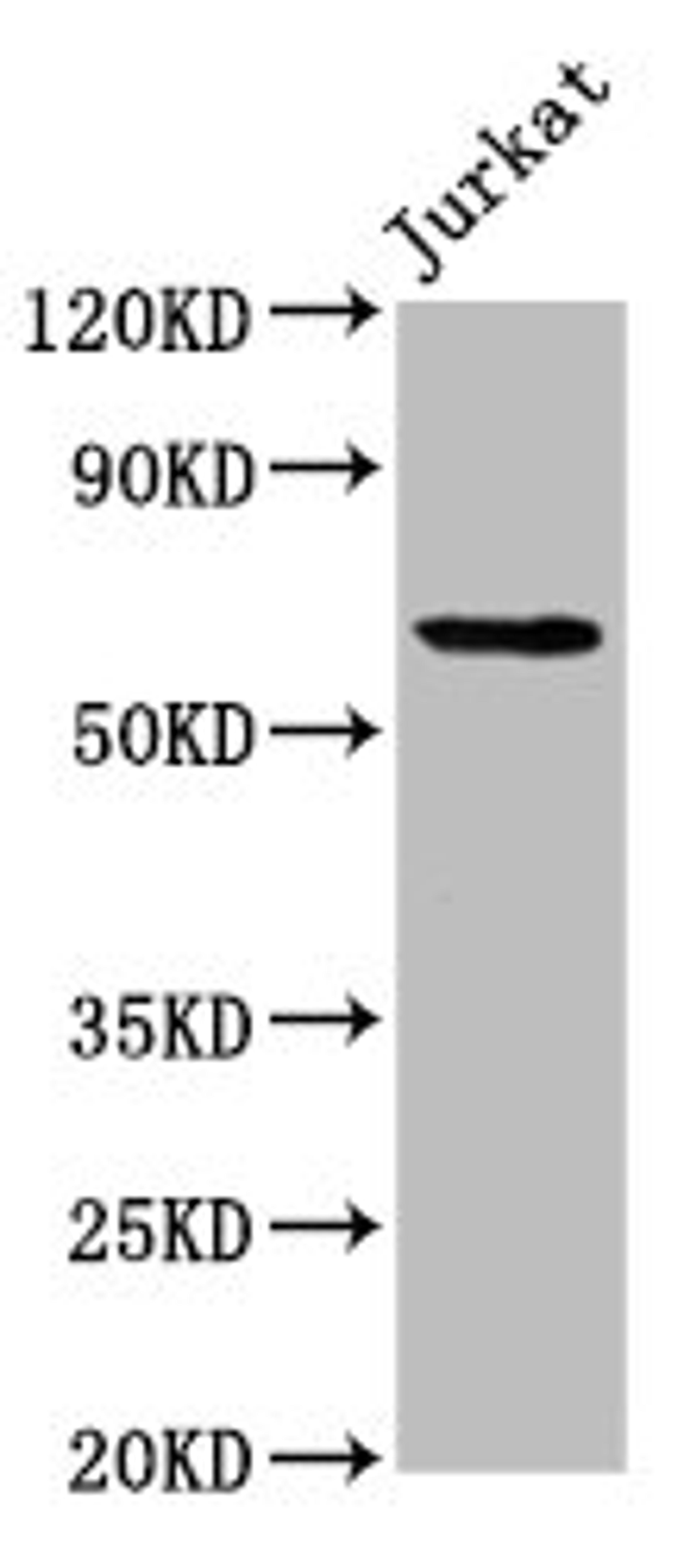 Western Blot. Positive WB detected in: Jurkat whole cell lysate. All lanes: SLAIN1 antibody at 4.2µg/ml. Secondary. Goat polyclonal to rabbit IgG at 1/50000 dilution. Predicted band size: 61, 34, 21, 48 kDa. Observed band size: 61 kDa