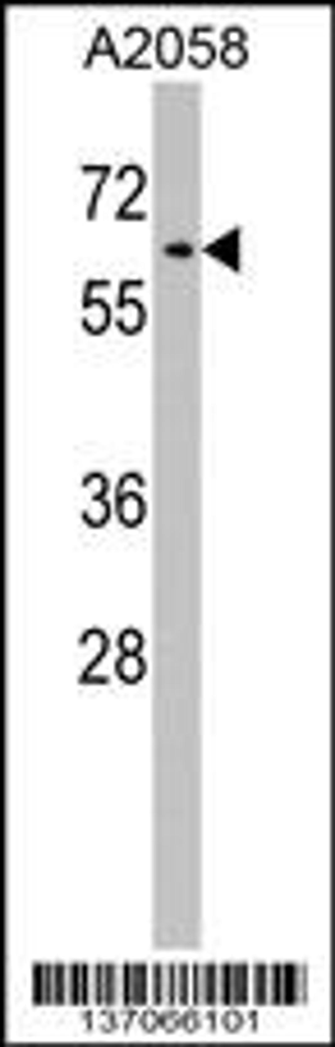 Western blot analysis in A2058 cell line lysates (35ug/lane).