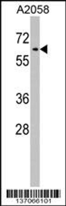 Western blot analysis in A2058 cell line lysates (35ug/lane).