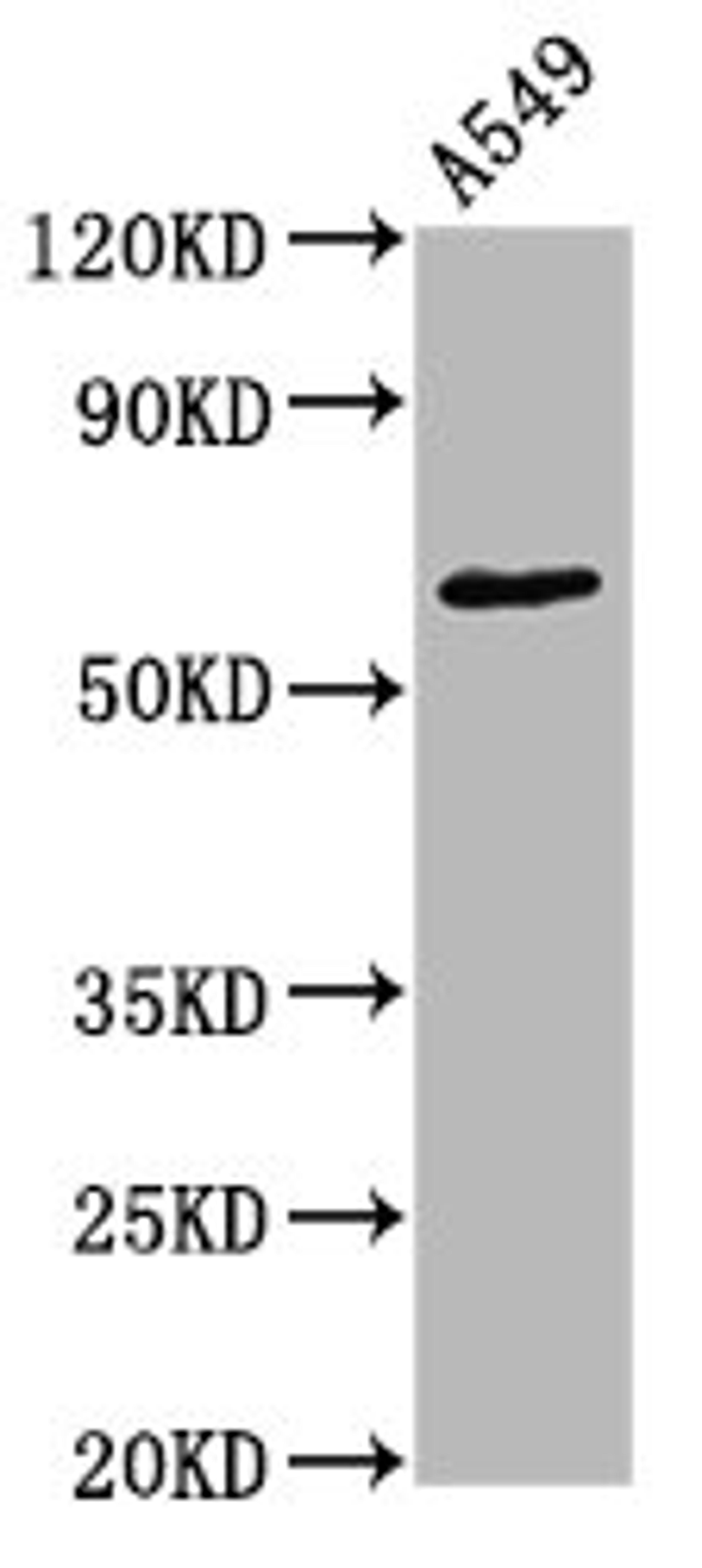 Western Blot. Positive WB detected in A549 whole cell lysate. All lanes Phospho-PRKCZ antibody at 1.55μg/ml. Secondary. Goat polyclonal to rabbit IgG at 1/50000 dilution. Predicted band size: 68 KDa. Observed band size: 68 KDa. 