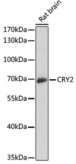 Western blot - CRY2 antibody (A6891)