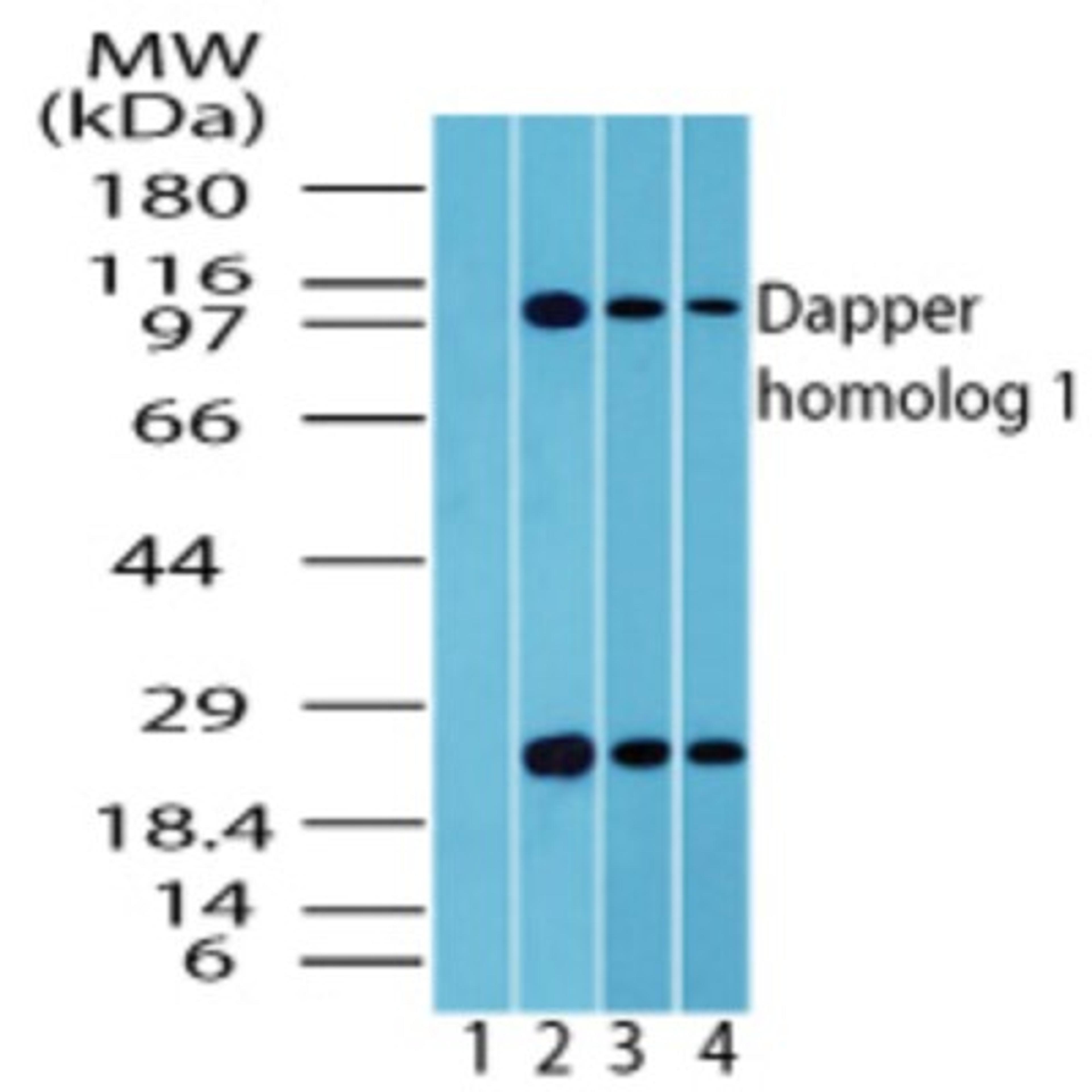 Western Blot: Dact1 Antibody [NBP2-24768] - analysis of Dapper homolog 1 in brain lysate. Lane 1 shows pre-immune sera. Lanes 2, 3 and 4 show this antibody. 5 ug/ml) and rat brain (0.5 ug/ml) lysate.