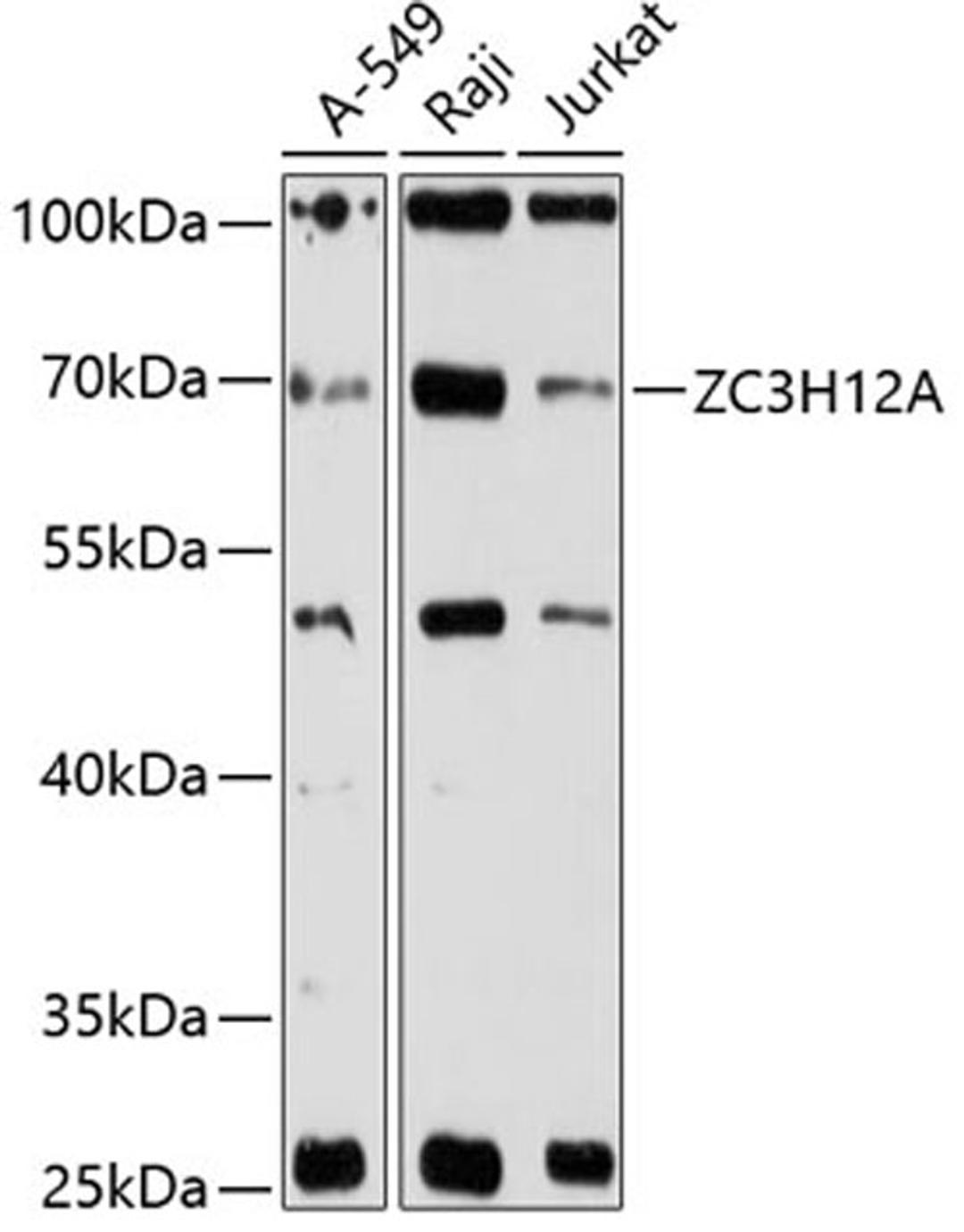 Western blot - ZC3H12A antibody (A12667)