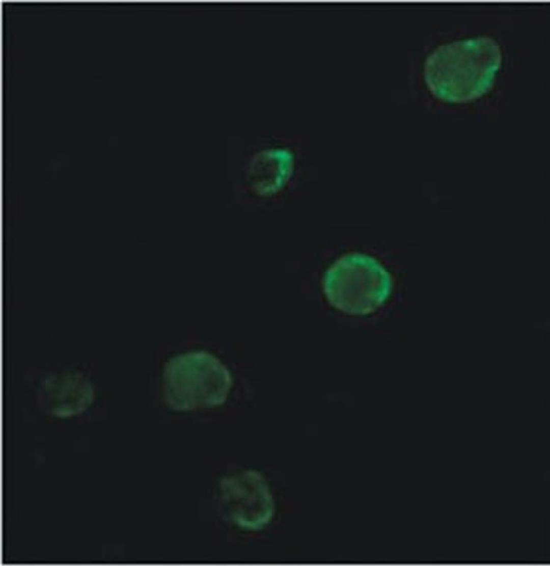 Immunocytochemistry/Immunofluorescence: Calreticulin Antibody [NB600-101] - Immunofluorescence staining of Calreticulin in HCT15 colon cancer cells using NB600-101. Secondary antibody was an Alexa Fluor 488. Photo courtesy of Dr. Birkenkamp Demtroeder, Arhus University Hospital.