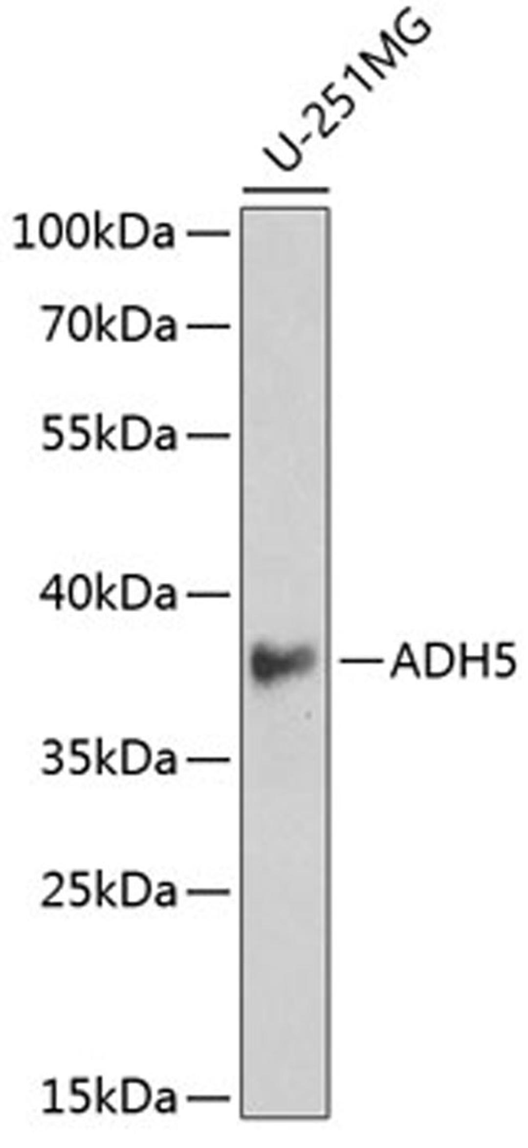 Western blot - ADH5 antibody (A13459)