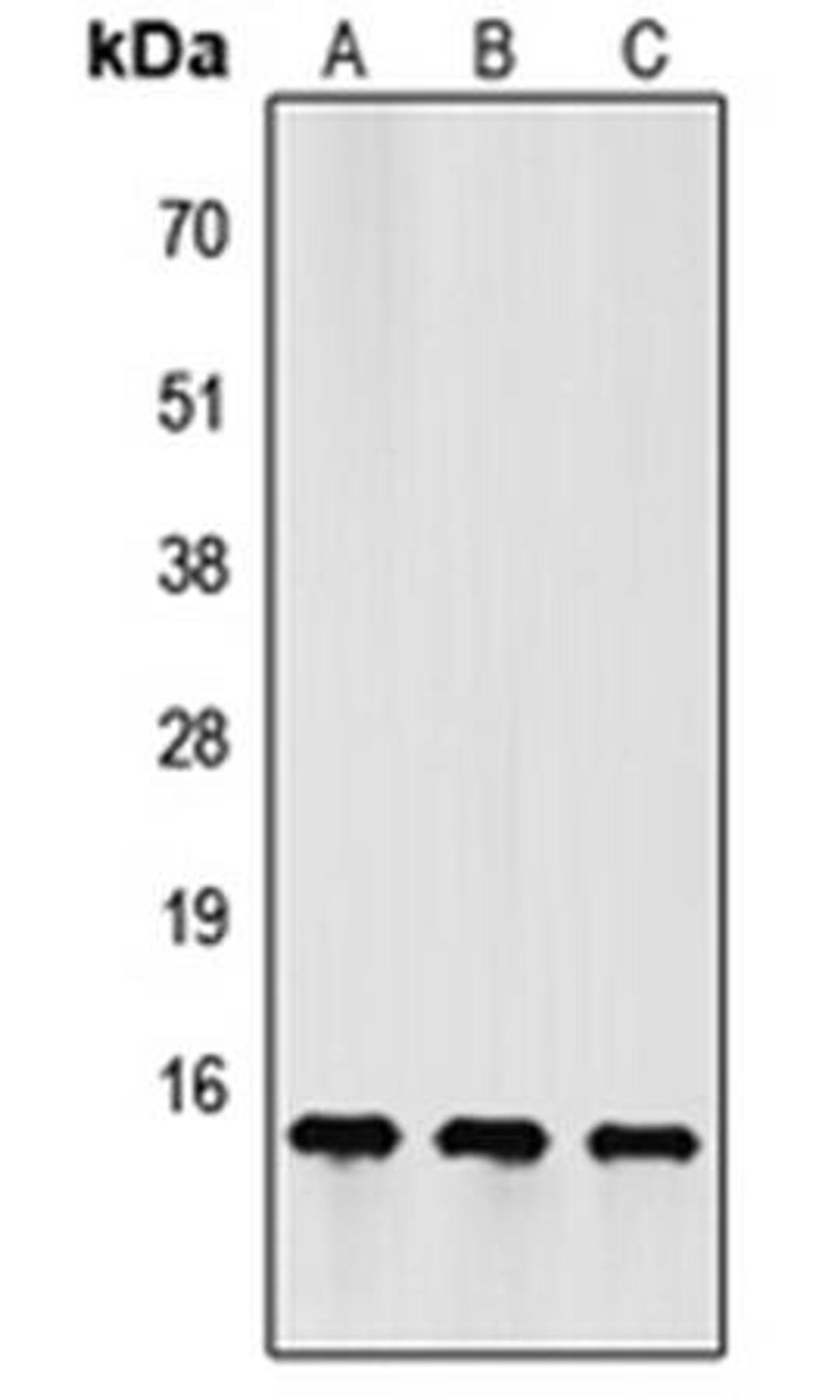 Western blot analysis of HeLa (Lane1), Raw264.7 (Lane2), PC12 (Lane3) whole cell using FSH beta antibody