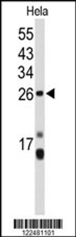 Western blot analysis of CENPH Antibody in Hela cell line lysates (35ug/lane)