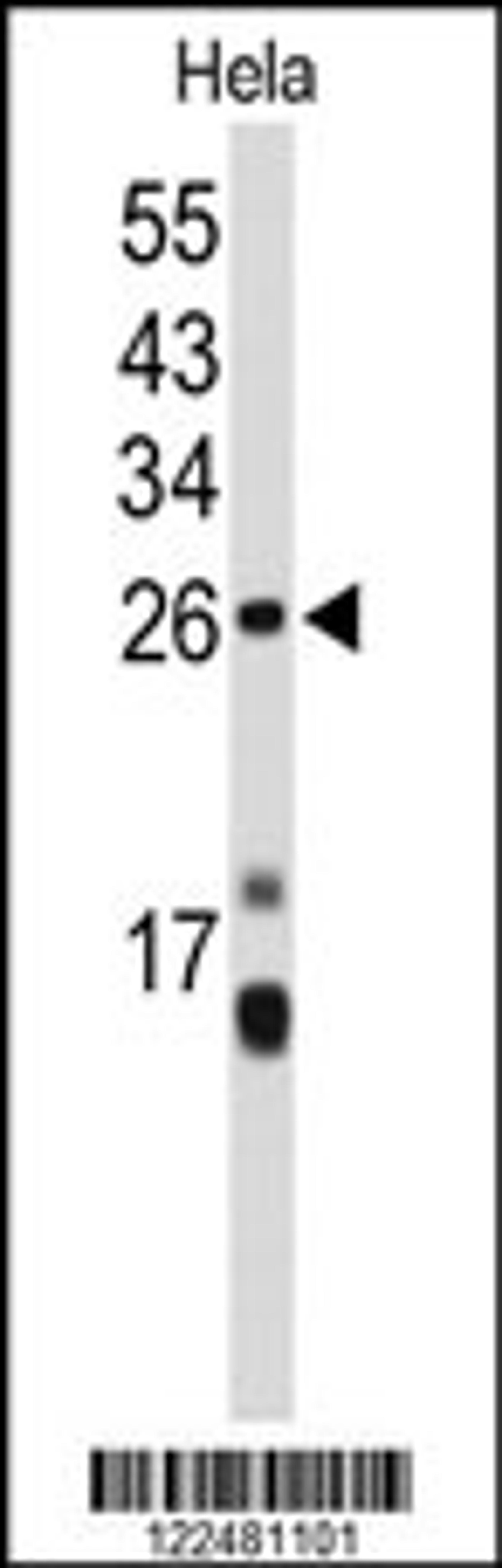 Western blot analysis of CENPH Antibody in Hela cell line lysates (35ug/lane)