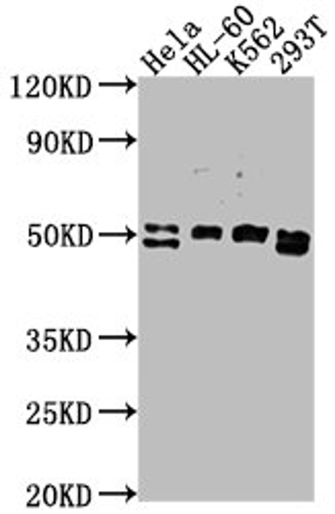 Western Blot. Positive WB detected in: HeLa whole cell lysate, HL-60 whole cell lysate, K562 whole cell lysate, 293T whole cell lysate. All lanes: DDX47 antibody at 1:2000. Secondary. Goat polyclonal to rabbit IgG at 1/50000 dilution. Predicted band size: 51, 46 kDa. Observed band size: 51 kDa.