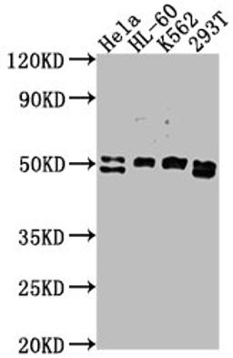 Western Blot. Positive WB detected in: HeLa whole cell lysate, HL-60 whole cell lysate, K562 whole cell lysate, 293T whole cell lysate. All lanes: DDX47 antibody at 1:2000. Secondary. Goat polyclonal to rabbit IgG at 1/50000 dilution. Predicted band size: 51, 46 kDa. Observed band size: 51 kDa.