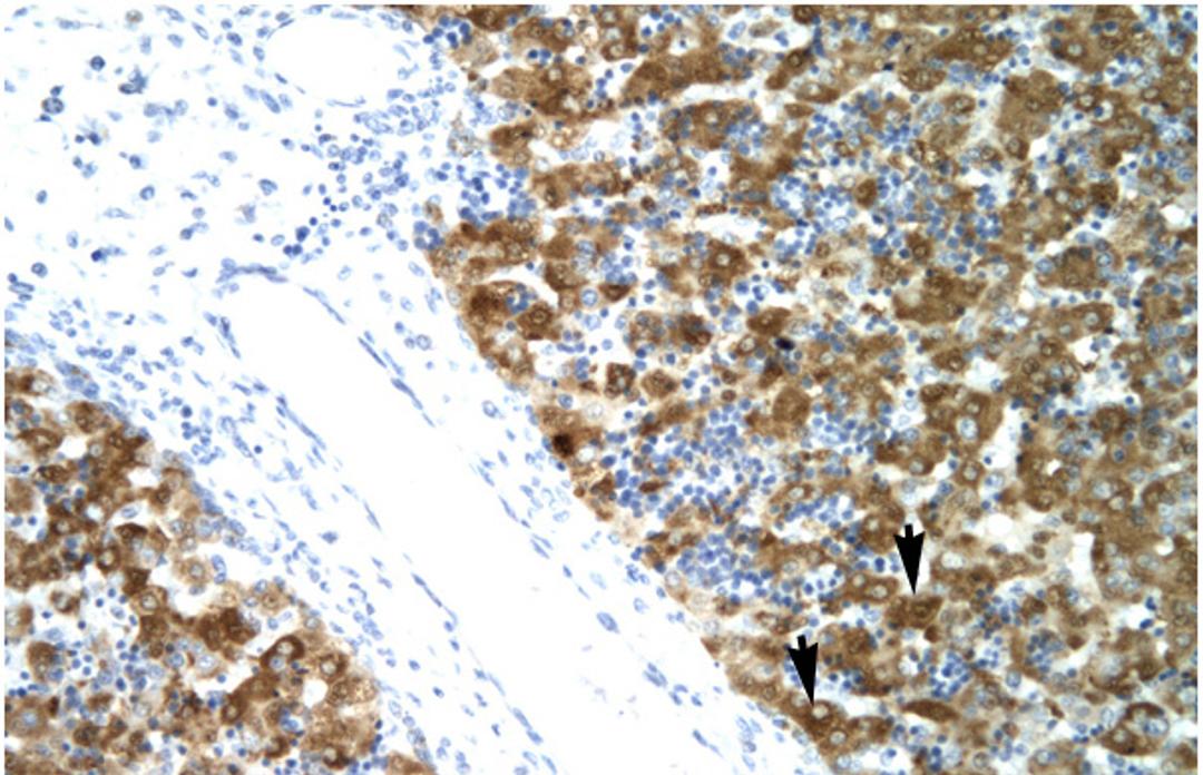 Antibody used in IHC on Human Liver cell lysates.