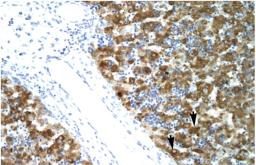 Antibody used in IHC on Human Liver cell lysates.