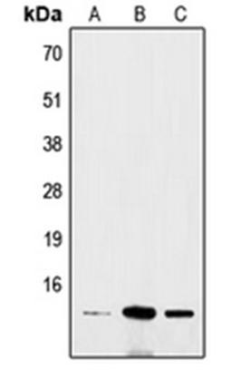 Western blot analysis of Hela (Lane 1), mouse brain (Lane 2), rat colon (Lane 3) whole cell lysates using BRI3 antibody