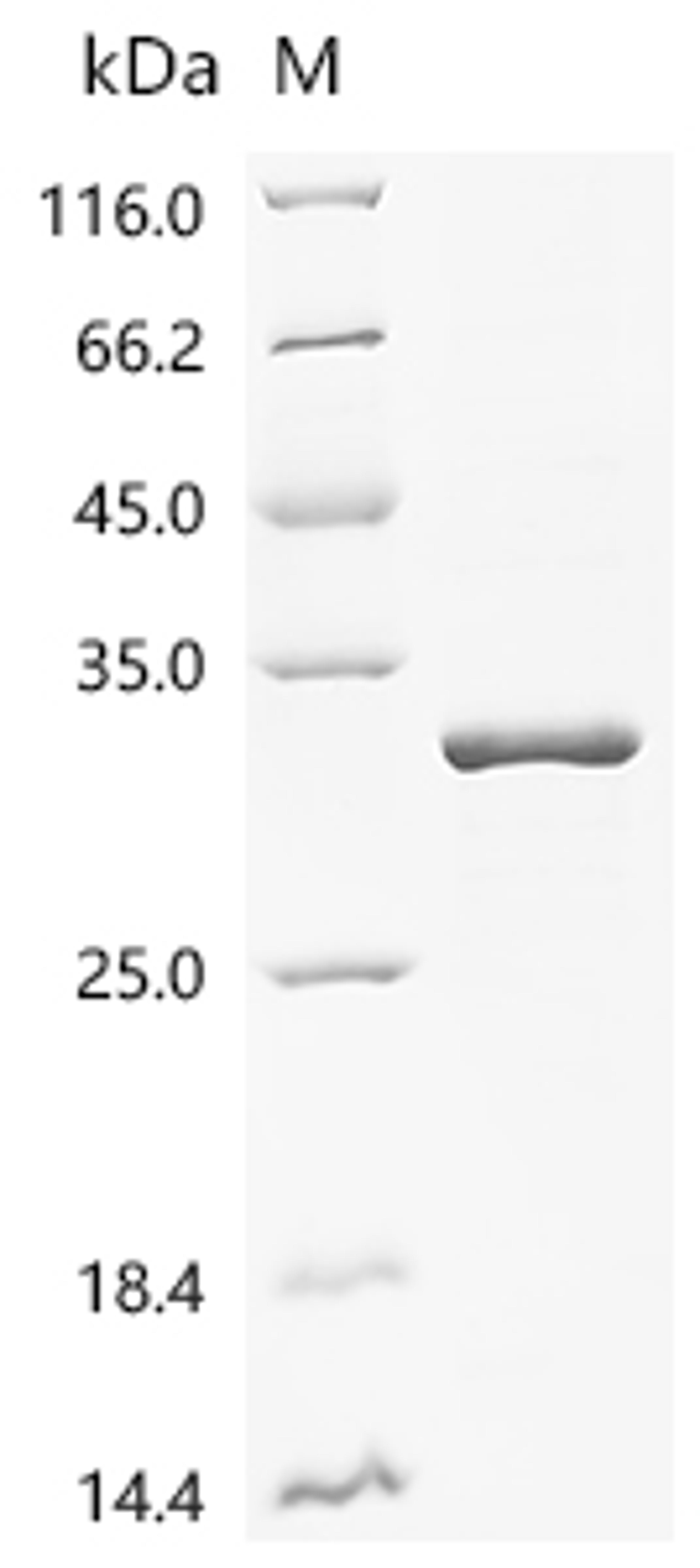 (Tris-Glycine gel) Discontinuous SDS-PAGE (reduced) with 5% enrichment gel and 15% separation gel.