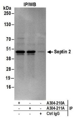 Detection of human Septin 2 by western blot of immunoprecipitates.