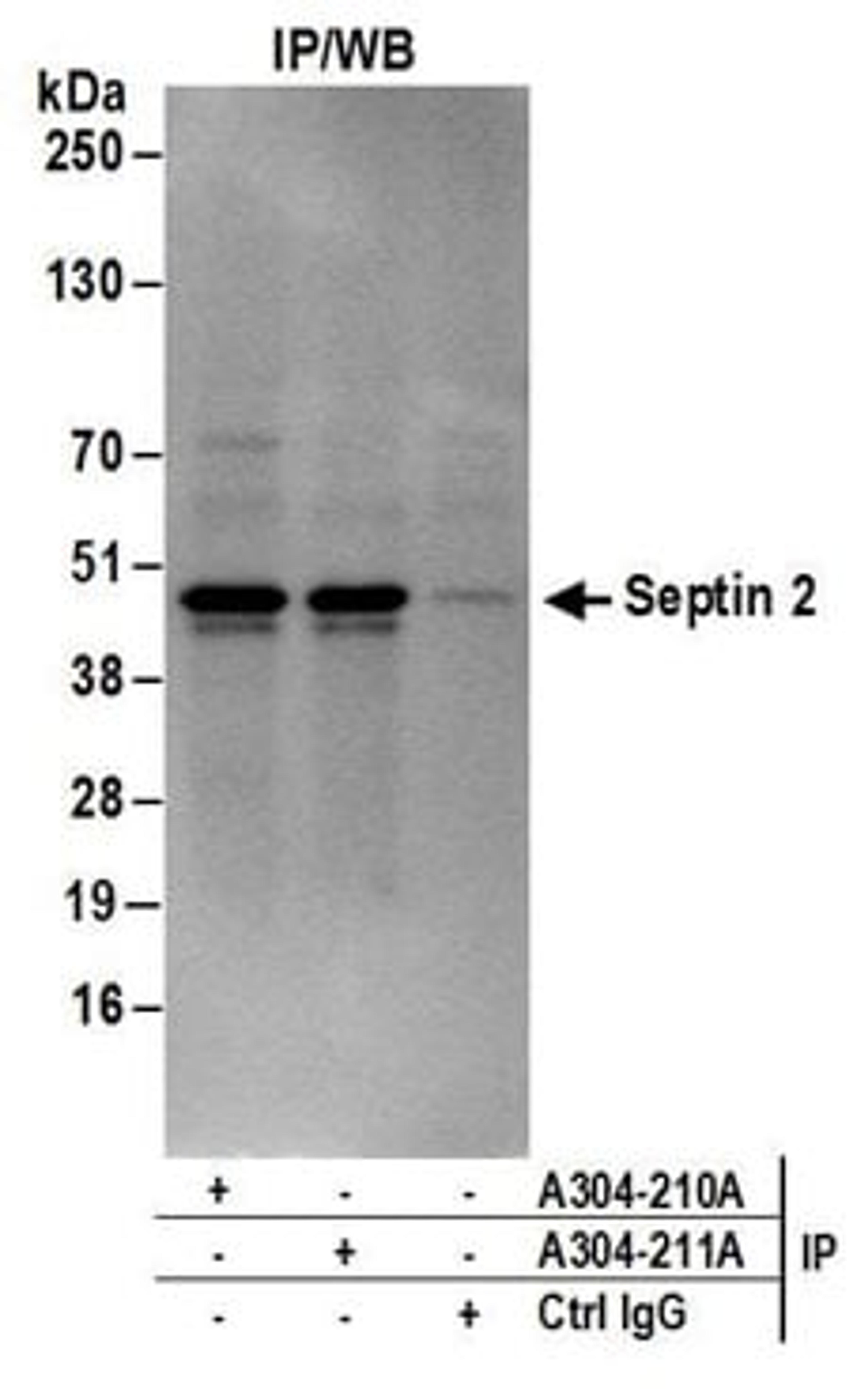 Detection of human Septin 2 by western blot of immunoprecipitates.