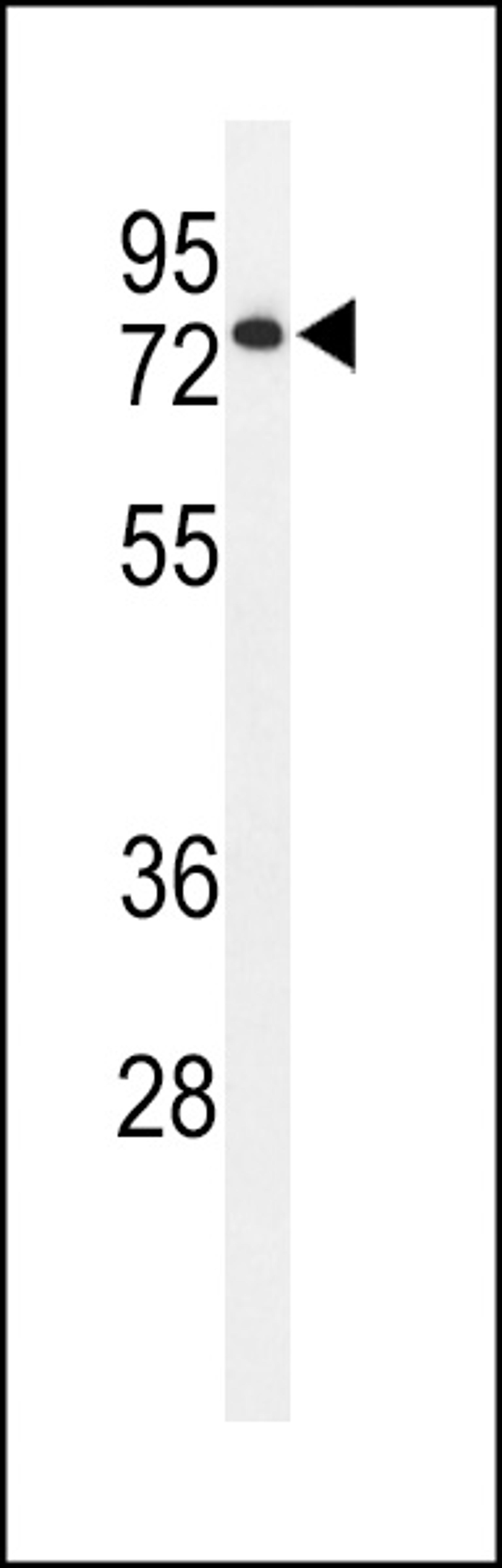 Western blot analysis of ENPP7 Antibody in HL-60 cell line lysates (35ug/lane)