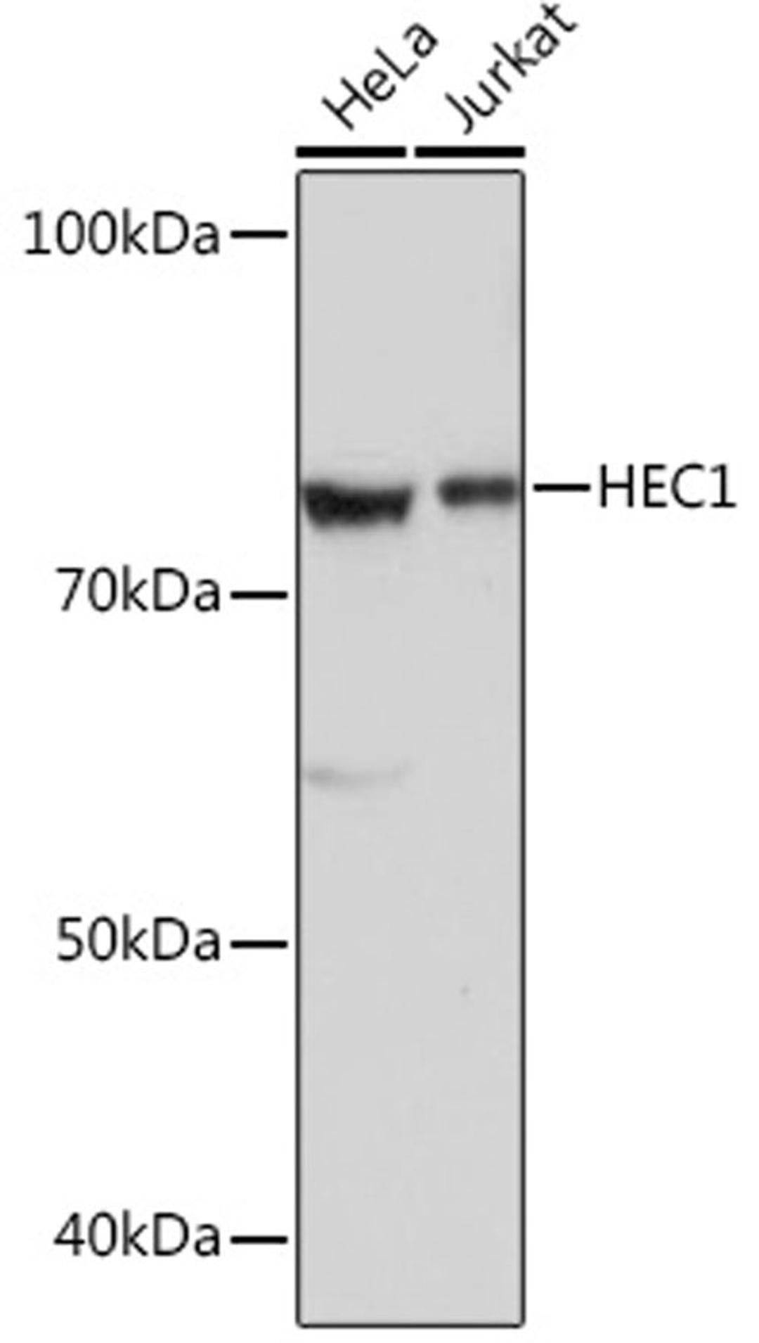 Western blot - HEC1 Rabbit mAb (A2392)