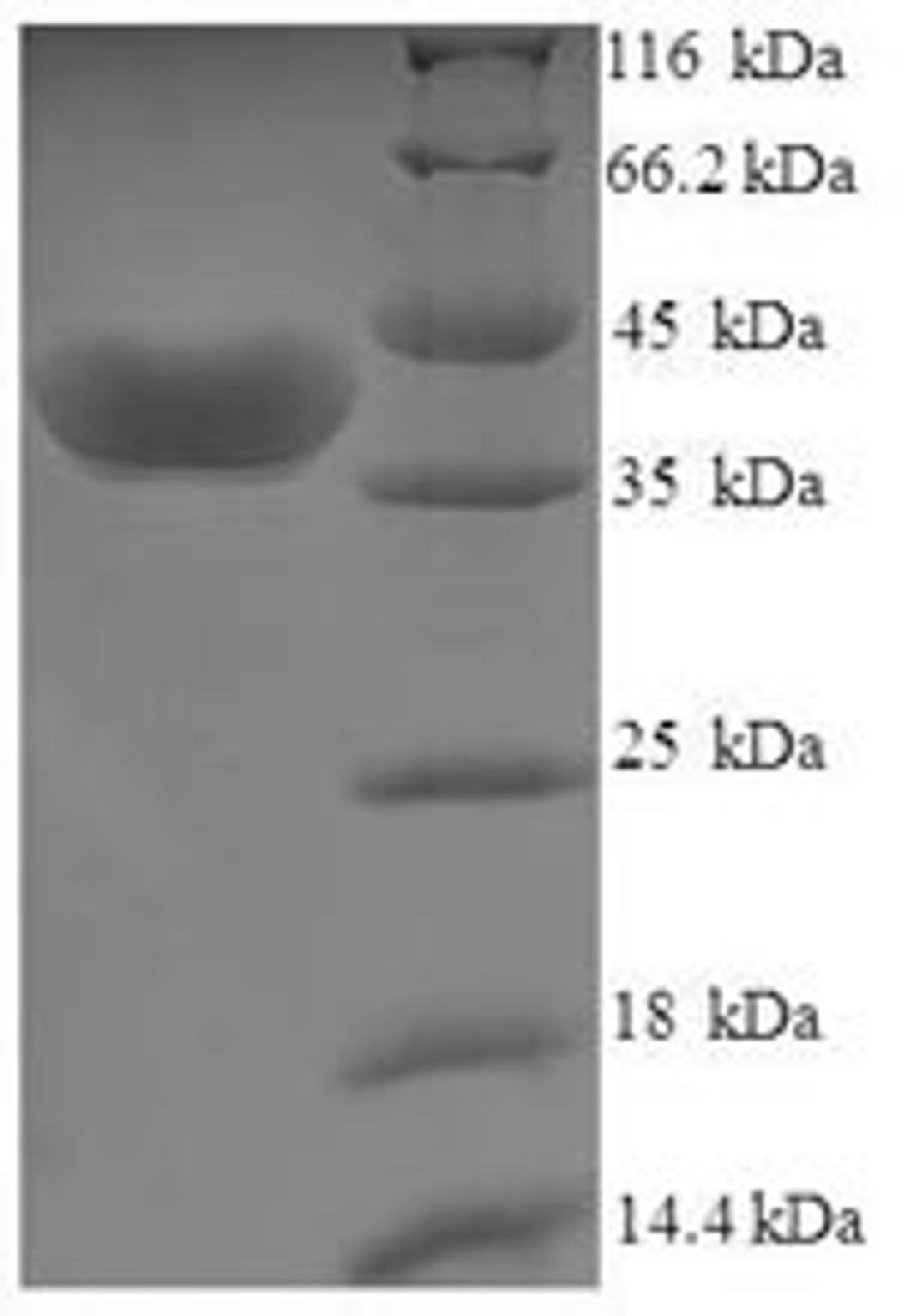 (Tris-Glycine gel) Discontinuous SDS-PAGE (reduced) with 5% enrichment gel and 15% separation gel.