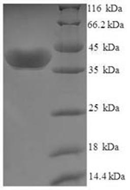 (Tris-Glycine gel) Discontinuous SDS-PAGE (reduced) with 5% enrichment gel and 15% separation gel.