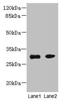 Western blot. All lanes: PI4KAP1 antibody at 10µg/ml. Lane 1: Mouse gonadal tissue. Lane 2: 293T whole cell lysate. Secondary. Goat polyclonal to rabbit IgG at 1/10000 dilution. Predicted band size: 30 kDa. Observed band size: 30 kDa