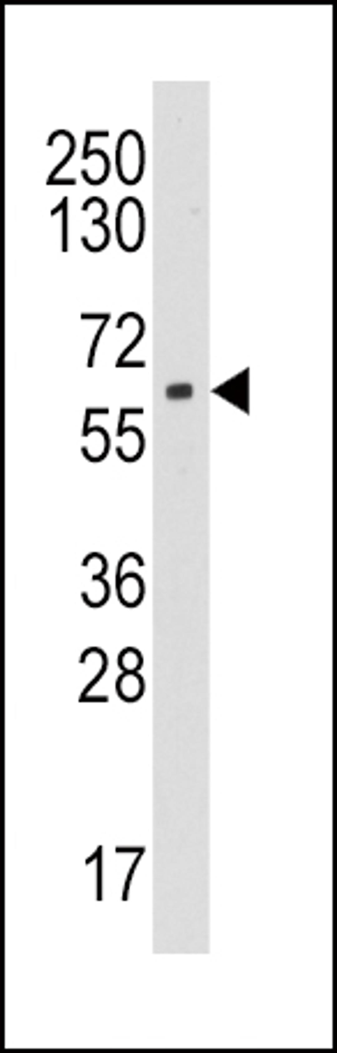 Western blot analysis of anti-CYP19A1 Pab in HL60 cell line lysates (35ug/lane).