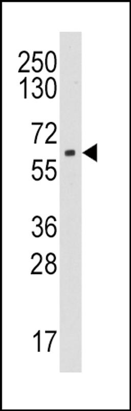 Western blot analysis of anti-CYP19A1 Pab in HL60 cell line lysates (35ug/lane).