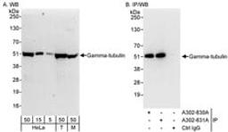 Detection of human and mouse Gamma-tubulin by western blot (h & m) and immunoprecipitation (h).