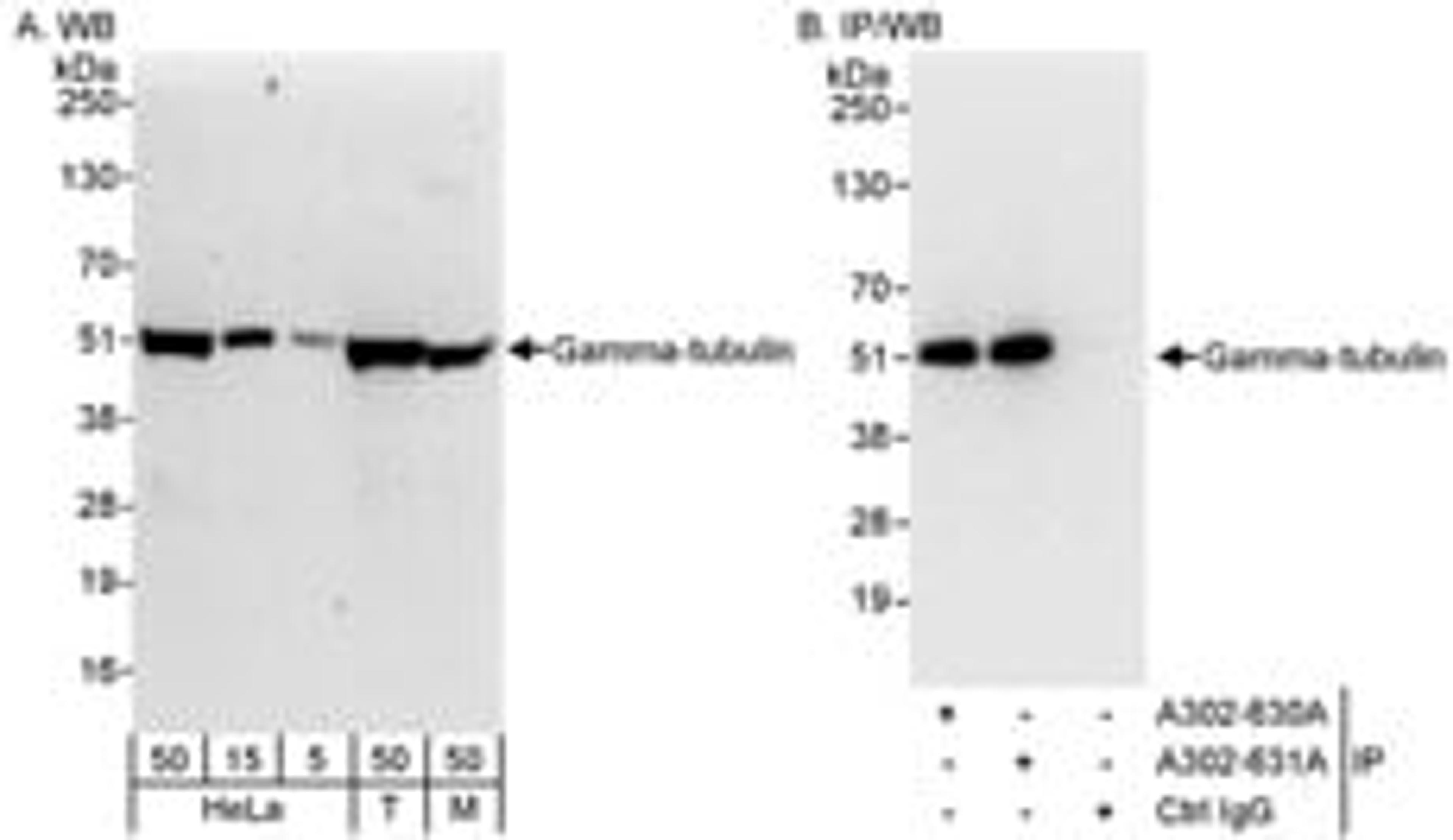 Detection of human and mouse Gamma-tubulin by western blot (h & m) and immunoprecipitation (h).