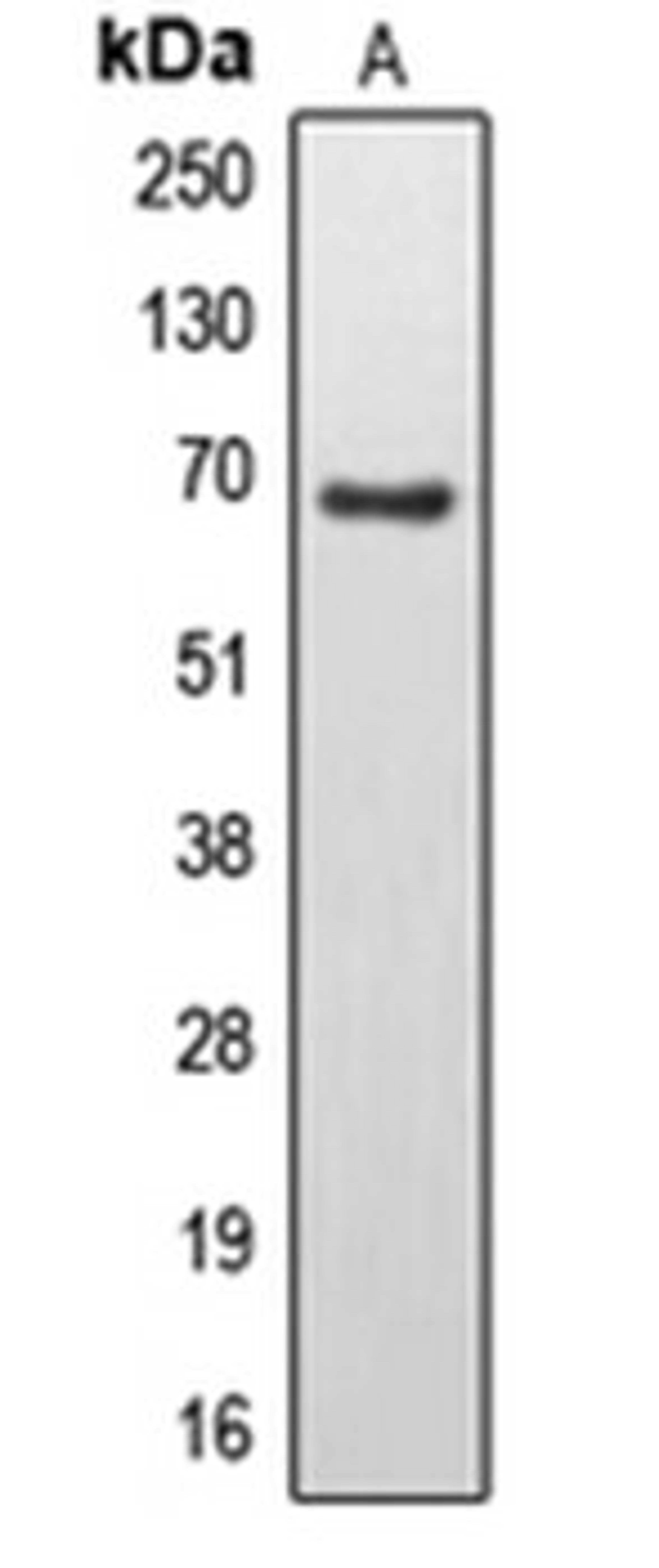 Western blot analysis of U251MG (Lane 1) whole cell lysates using EPS8L3 antibody