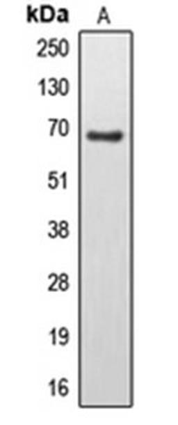 Western blot analysis of U251MG (Lane 1) whole cell lysates using EPS8L3 antibody