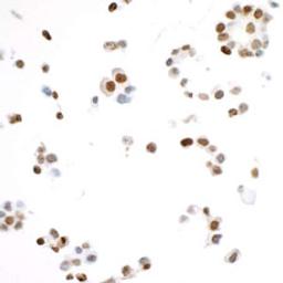 Detection of human Ki-67 in FFPE OVCAR-4 cells by ICC.