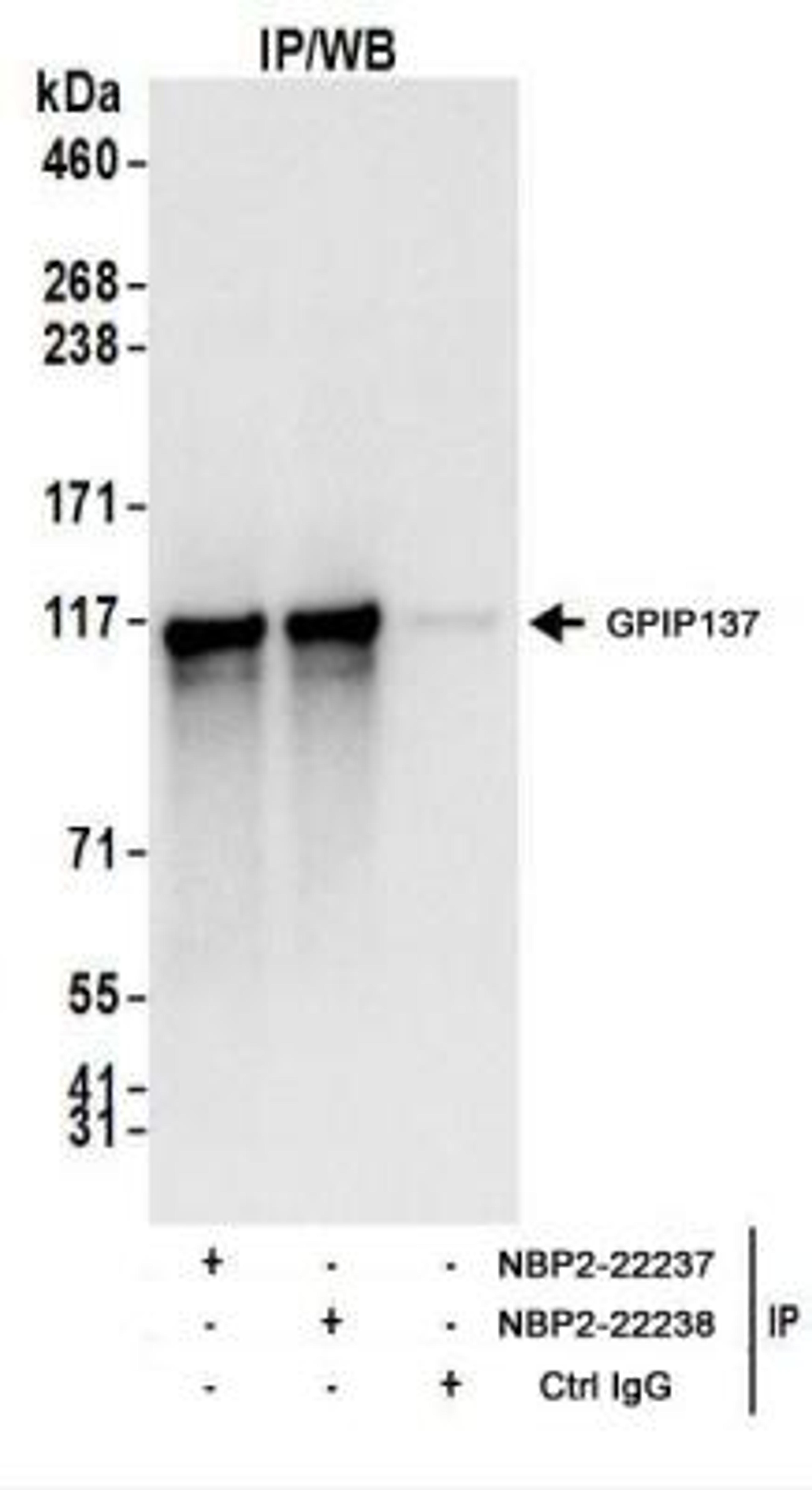 Immunoprecipitation: GPIP137 Antibody [NBP2-22238] - Whole cell lysate (1 mg for IP; 20% of IP loaded) from HeLa cells.   Antibodies:  NBP2-22238 used for IP at 6 ug/mg lysate.  GPIP137 was also immunoprecipitated by rabbit anti-GPIP137 antibody NBP2-22237.  For blotting immunoprecipitated GPIP137, NBP2-22238 was used at 1 ug/ml.    Detection: Chemiluminescence with an exposure time of 3 seconds.