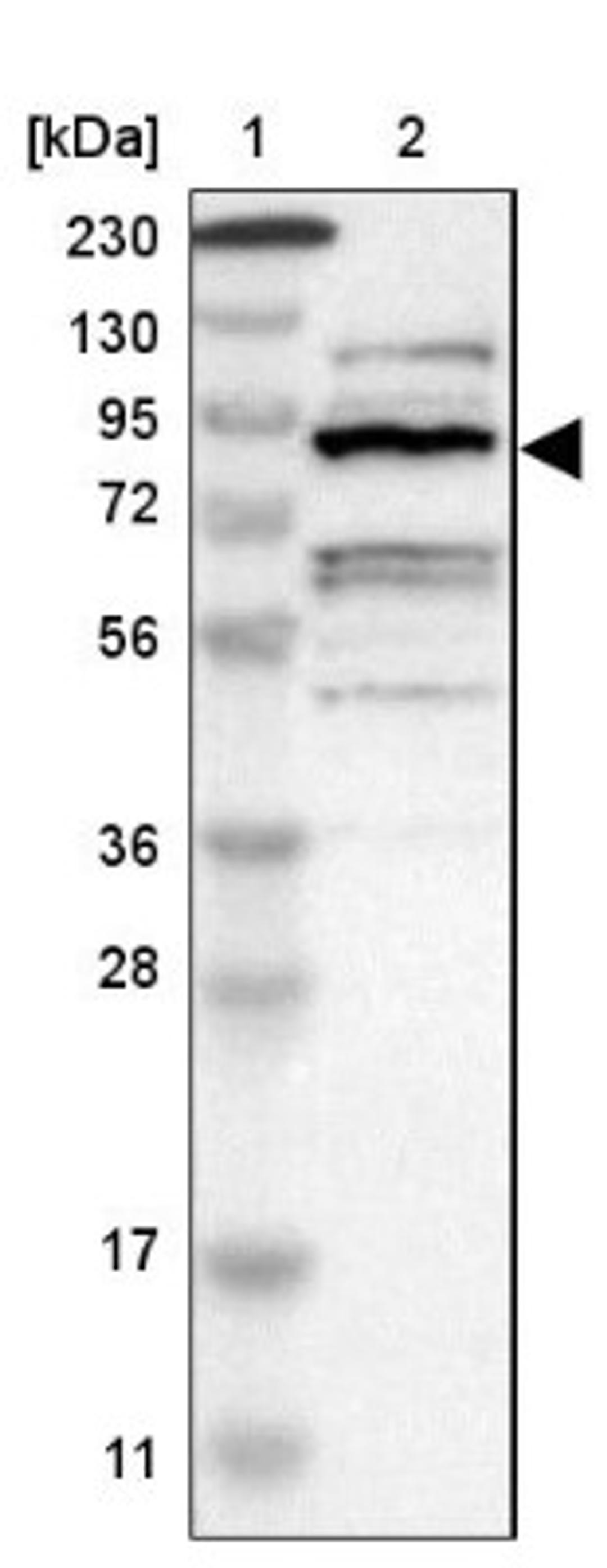 Western Blot: ZHX2 Antibody [NBP1-82956] - Lane 1: Marker [kDa] 230, 130, 95, 72, 56, 36, 28, 17, 11<br/>Lane 2: Human cell line RT-4