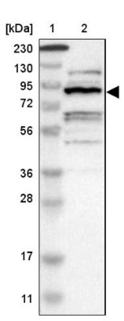 Western Blot: ZHX2 Antibody [NBP1-82956] - Lane 1: Marker [kDa] 230, 130, 95, 72, 56, 36, 28, 17, 11<br/>Lane 2: Human cell line RT-4