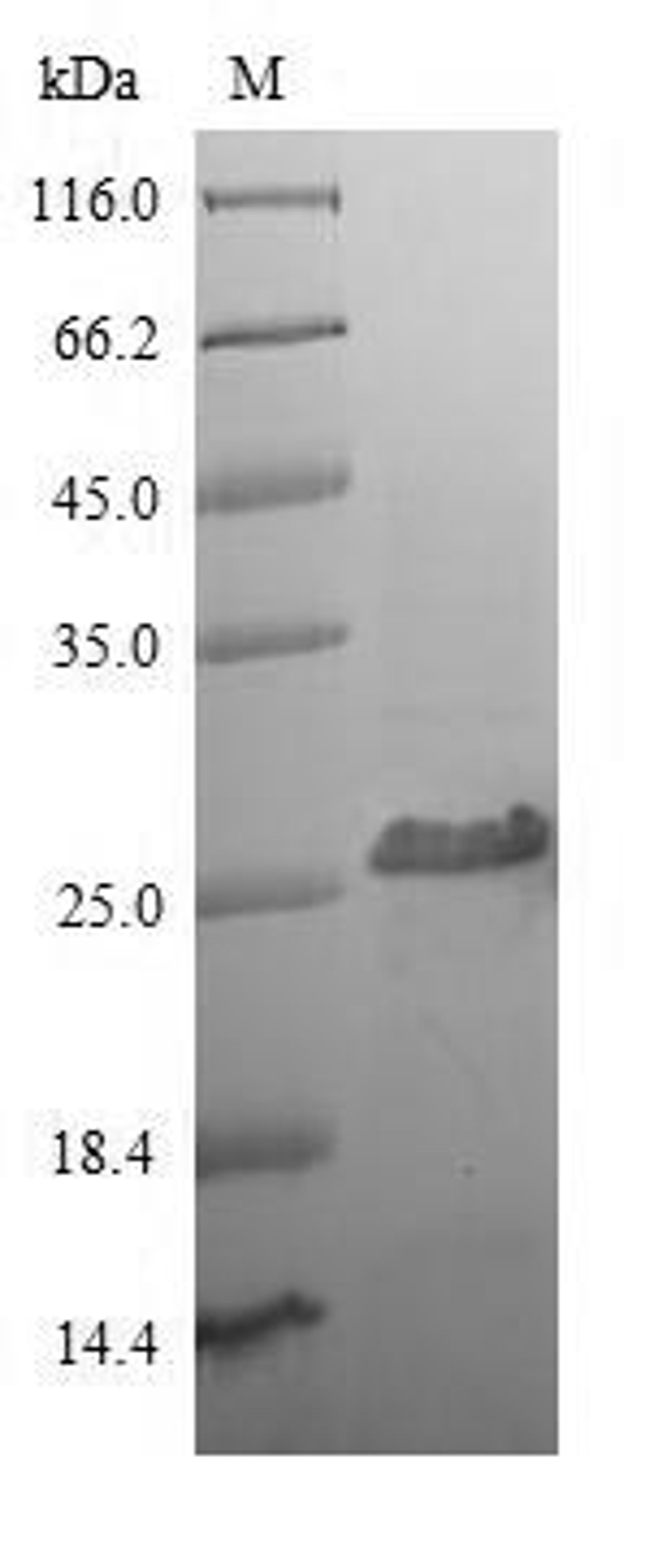 (Tris-Glycine gel) Discontinuous SDS-PAGE (reduced) with 5% enrichment gel and 15% separation gel.