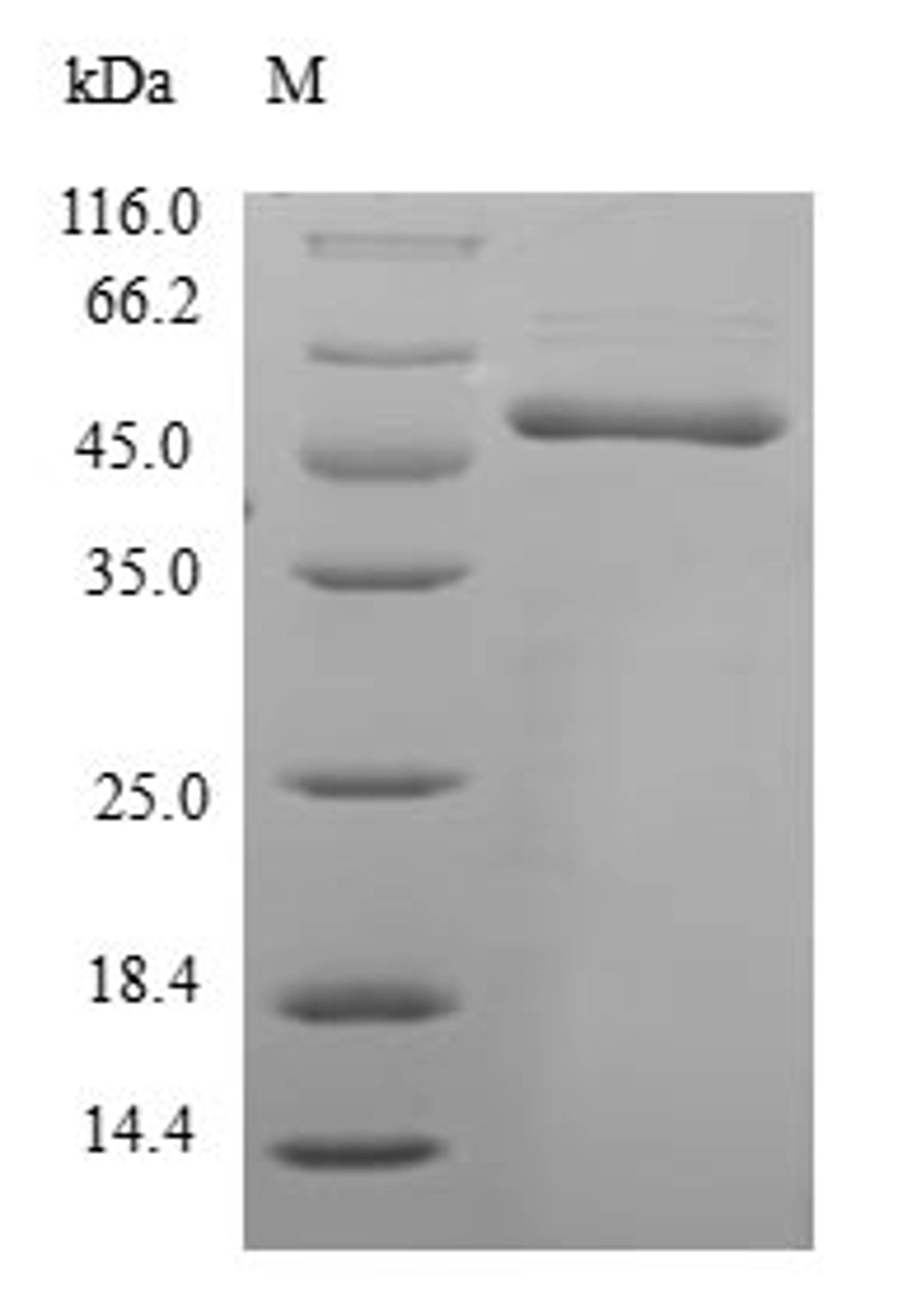 (Tris-Glycine gel) Discontinuous SDS-PAGE (reduced) with 5% enrichment gel and 15% separation gel.