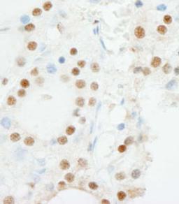 Detection of human ZNF318/TZF by immunohistochemistry.