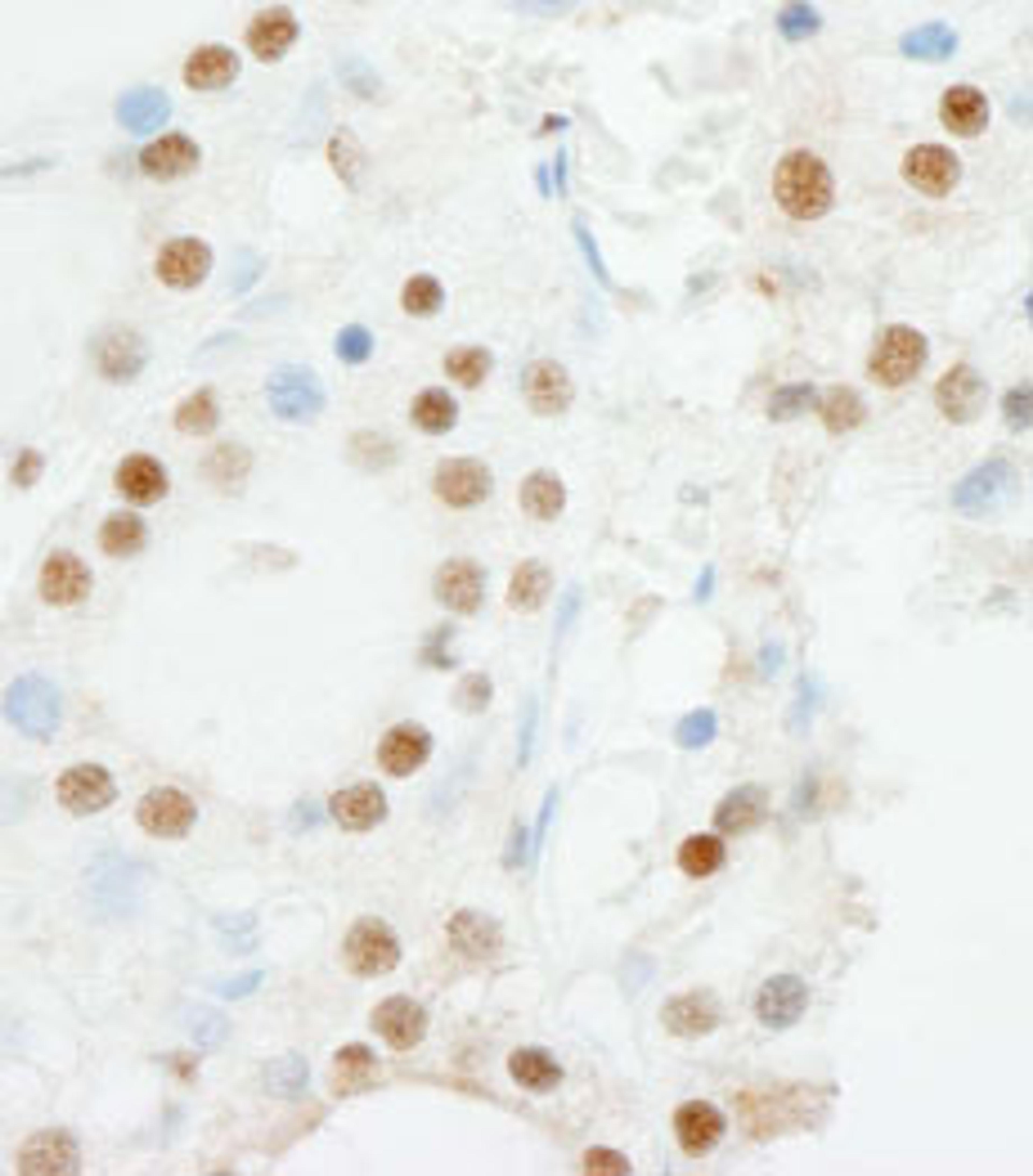 Detection of human ZNF318/TZF by immunohistochemistry.